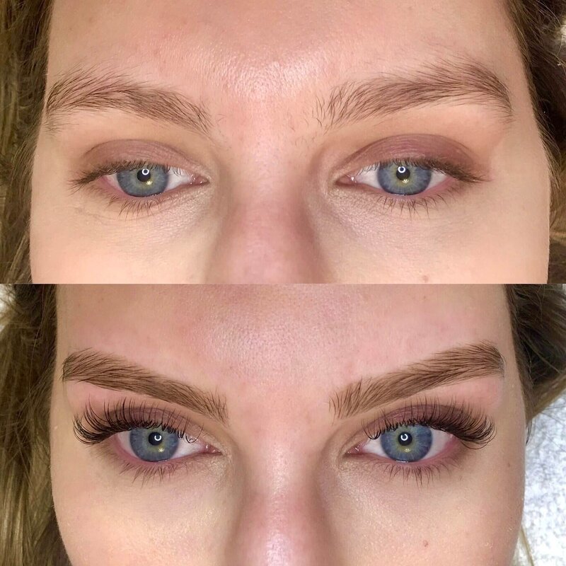 BEFORE&AFTER(6)