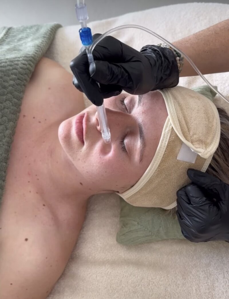 image soin jet peel
