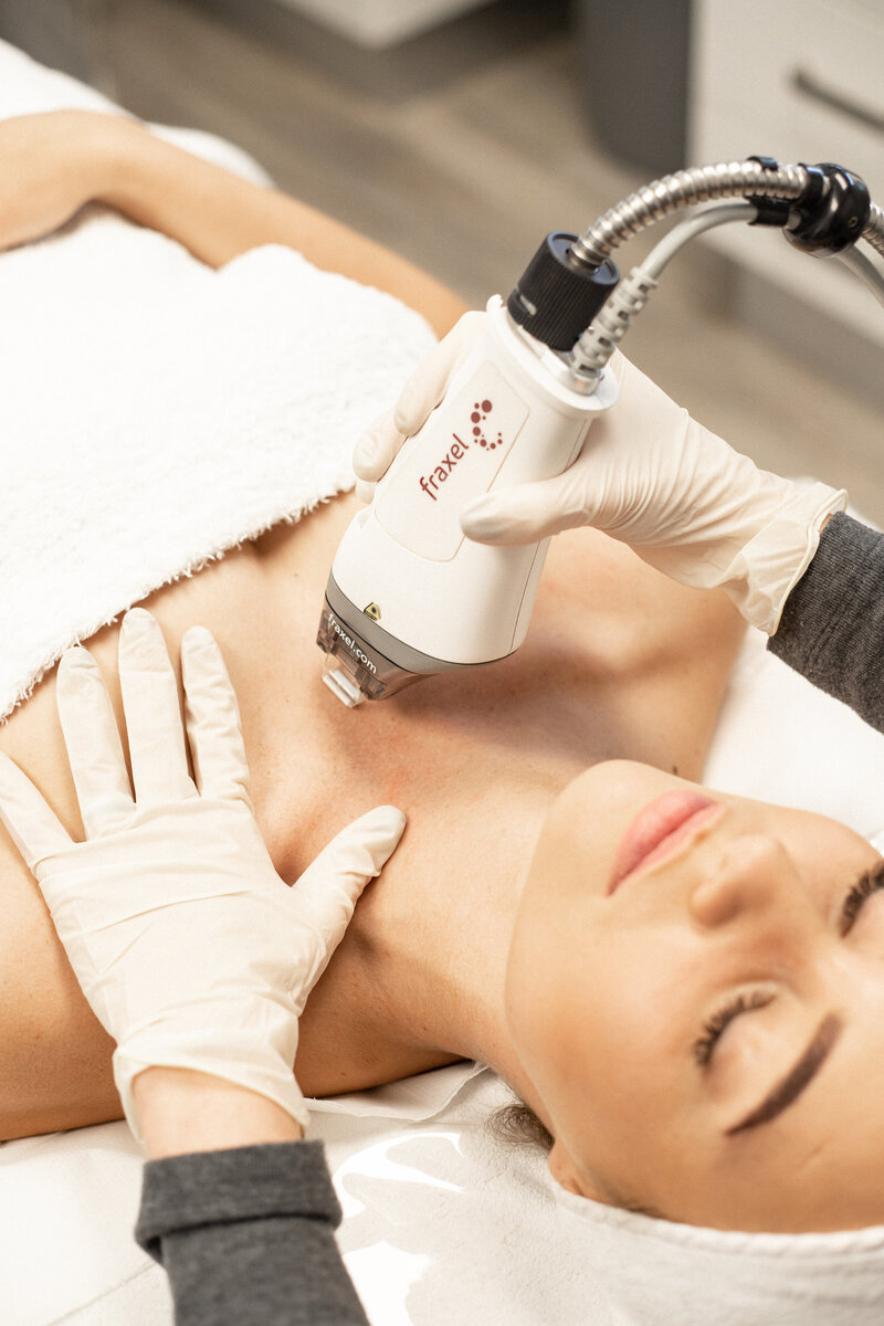 A woman lies on a treatment bed at Laserderm, receiving a Fraxel treatment on her chest area. Fraxel is a revolutionary laser resurfacing treatment that targets wrinkles, scars, and hyperpigmentation, restoring a youthful and radiant appearance. Trust Laserderm's expert team to deliver precise and effective Fraxel treatments for exceptional results.