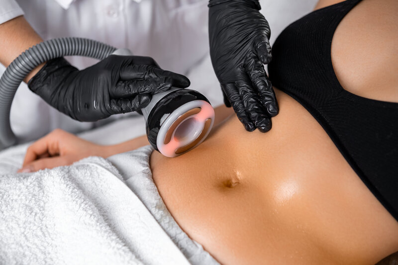 Fat Cavitation and body contouring treatment at luscious skin & beauty Warrnambool