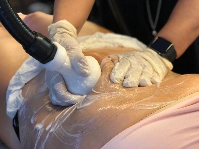 femme ayant un soijn par cryolipolyse sur aix en provence