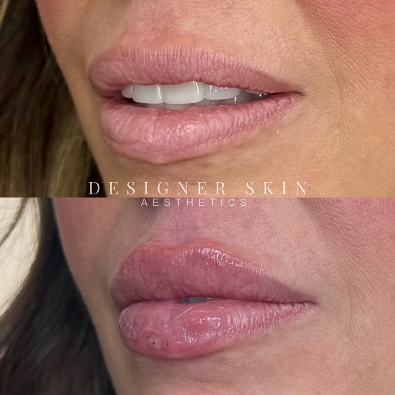 Facetune_23-12-2024-11-00-07