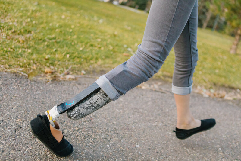 Close-up image of legs of an amputee walking with her prosthetics.