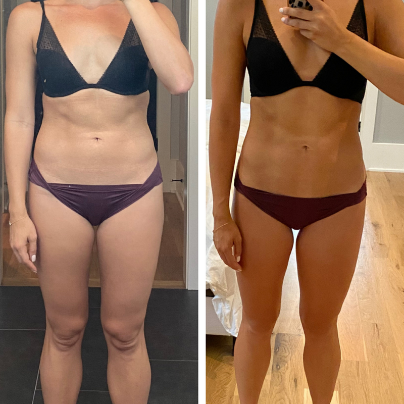 Before and after template_3FORMA Results-03