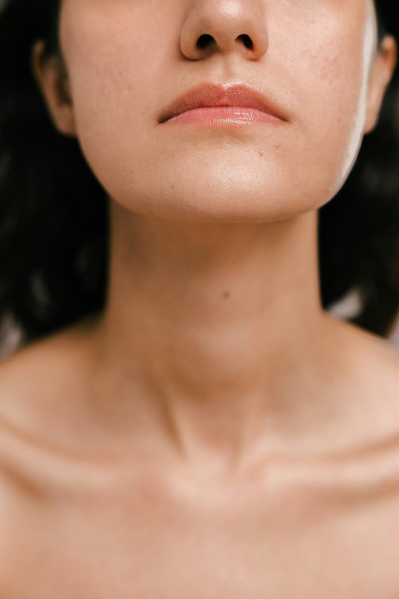 Lipodissolve on neck of woman