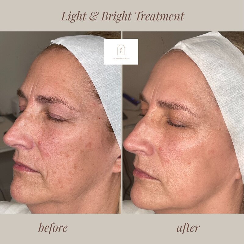 Medspa Treatments High Point