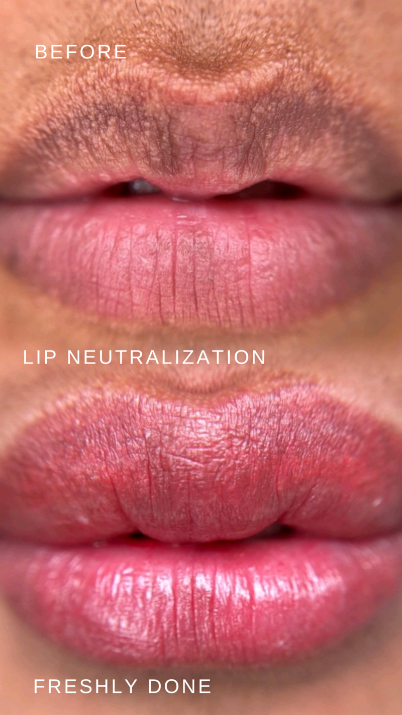 freshly done results of lip blush on melanin-rich lips with evened tone and warmth