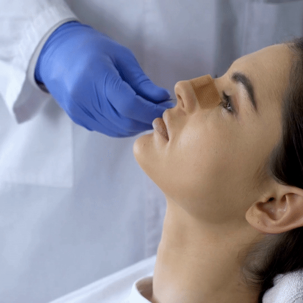 Gif of doctor taking bandage off a woman's nose