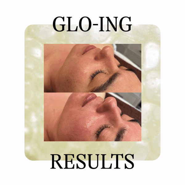 glo2 facial before and afters youthful glow