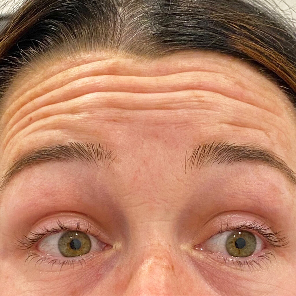 before image