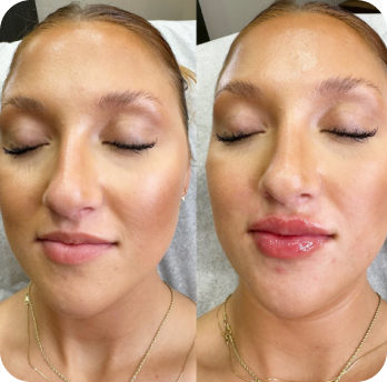 before-after