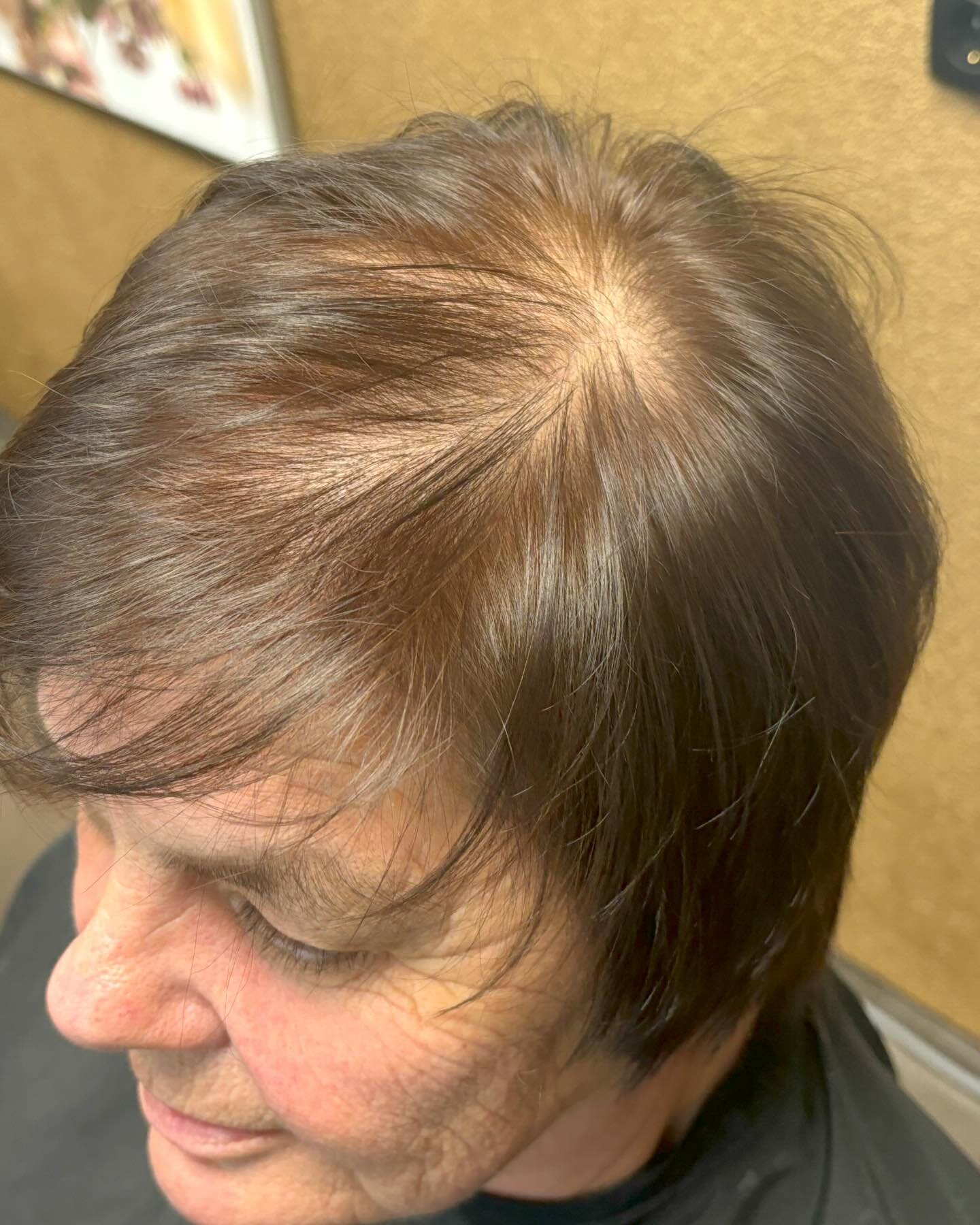 Before